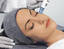 40%OFF Microdermabrasion Mississauga Brampton Milton Toronto